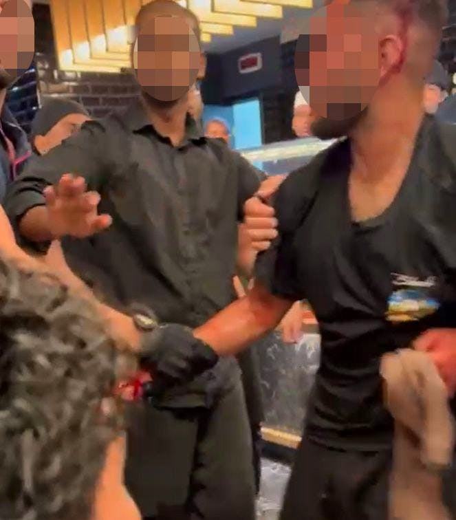 Sardinien Messer-Attacke in den Ferien – Schweizer hilft und wird verletzt 703 38