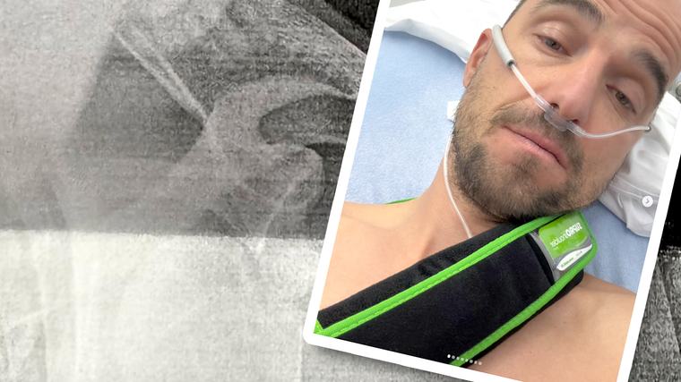 Mountainbike-Rentner Schurter verletzt sich bei Scooter-Unfall